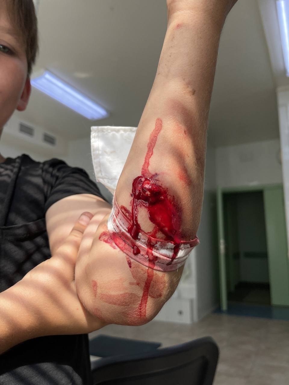 Стая бездомных собак терроризируют жителей микрорайона Юго-Западный 2.4 в Белгороде: в региональном СУ СК России возбудили уголовное дело Стая бездомных собак терроризируют жителей микрорайона Юго-Западный 2.4 в Белгороде: в региональном СУ СК России возбудили уголовное дело