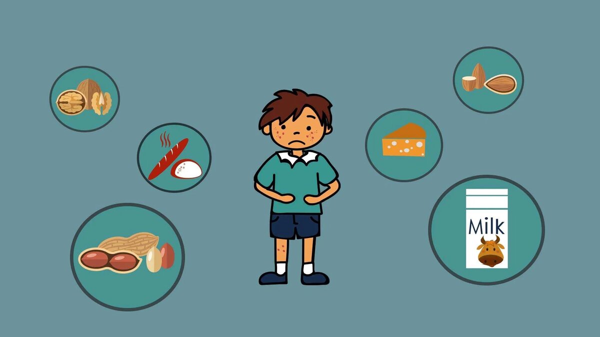 Пищевая непереносимость: причины и симптомы