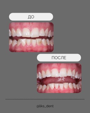 ��� ���������������� ������� ������� ��� ������ ���� ������